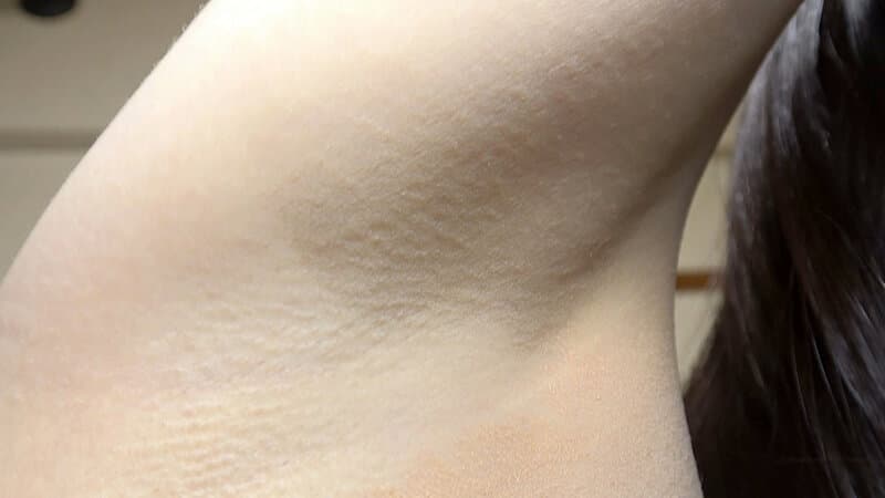 Sample 4