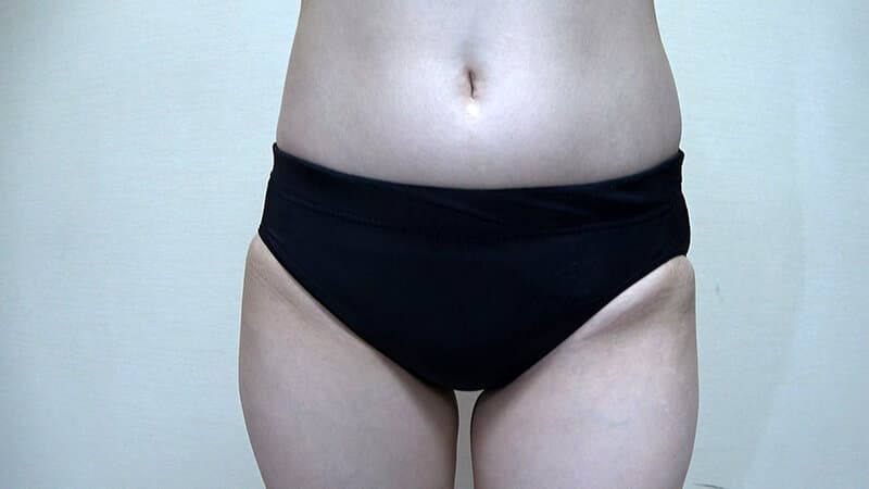 Sample 1