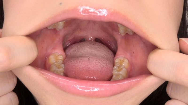 Sample 14