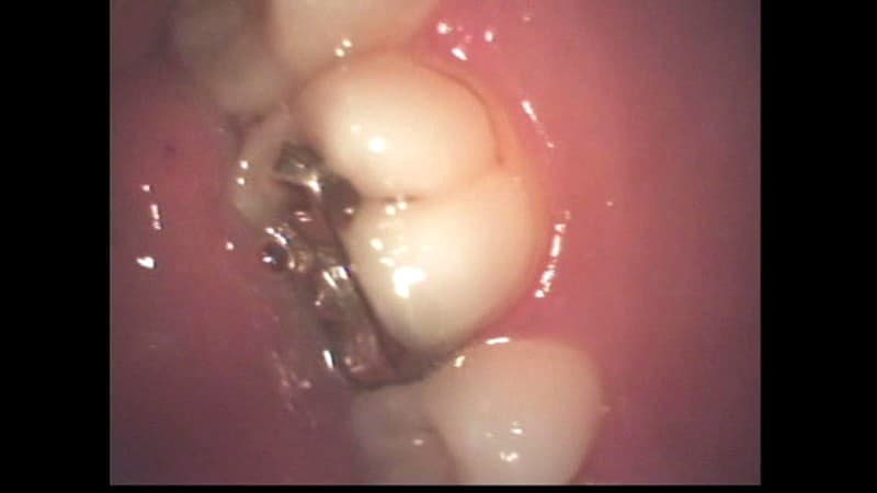 Sample 12