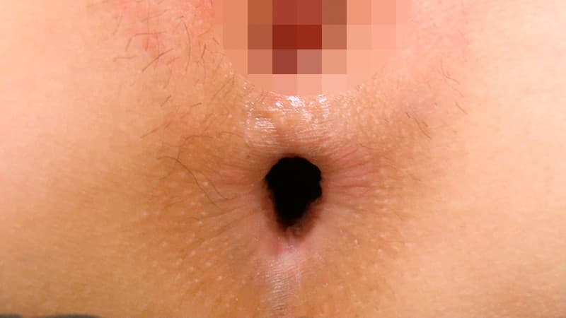Sample 8