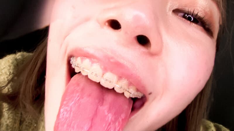 Sample 10