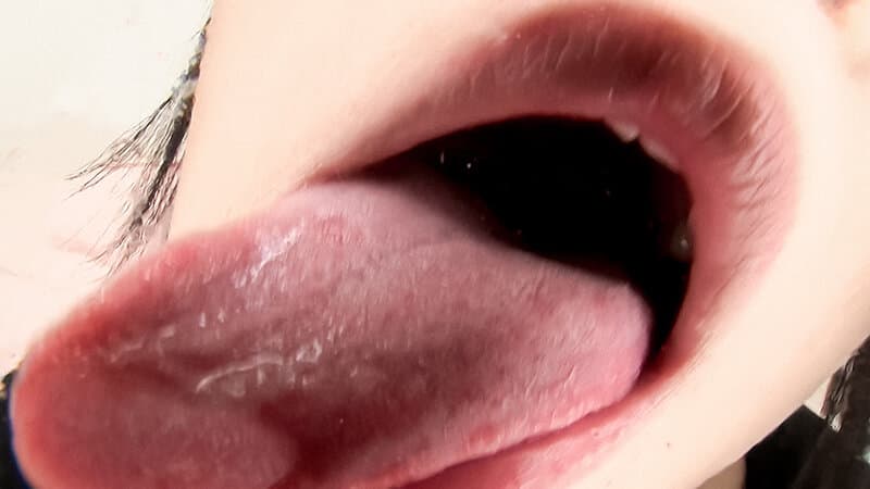 Sample 15