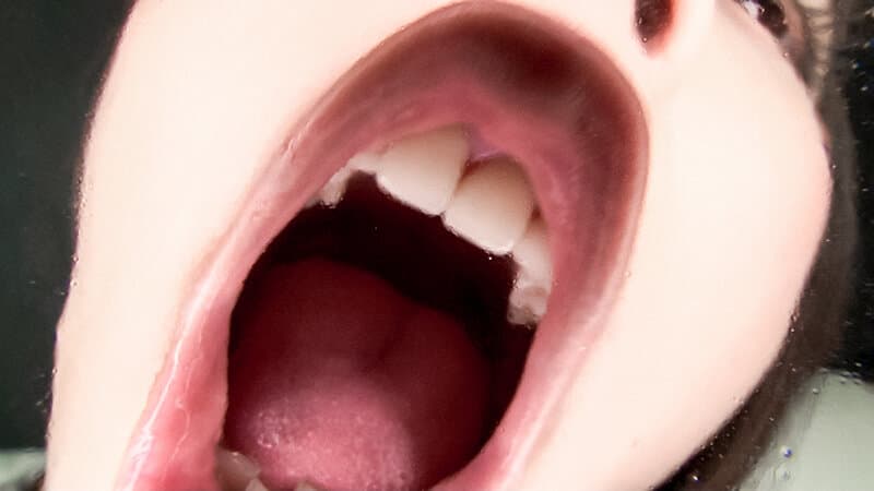 Sample 6