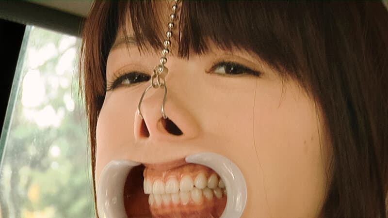 Sample 15