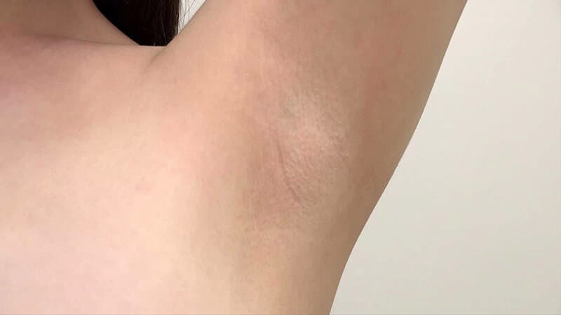 Sample 19