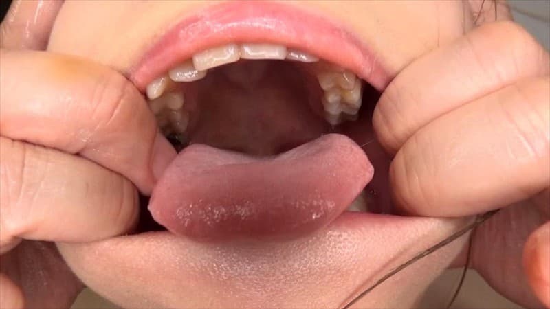 Sample 14