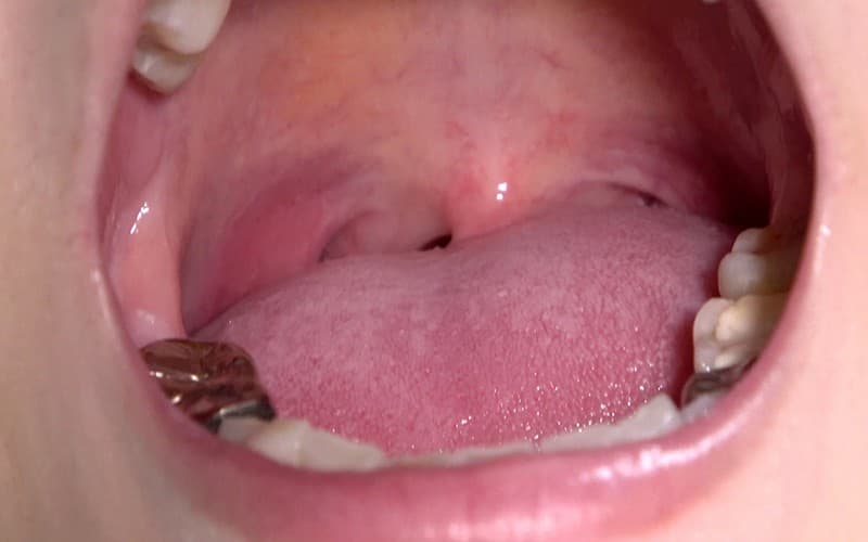 Sample 14