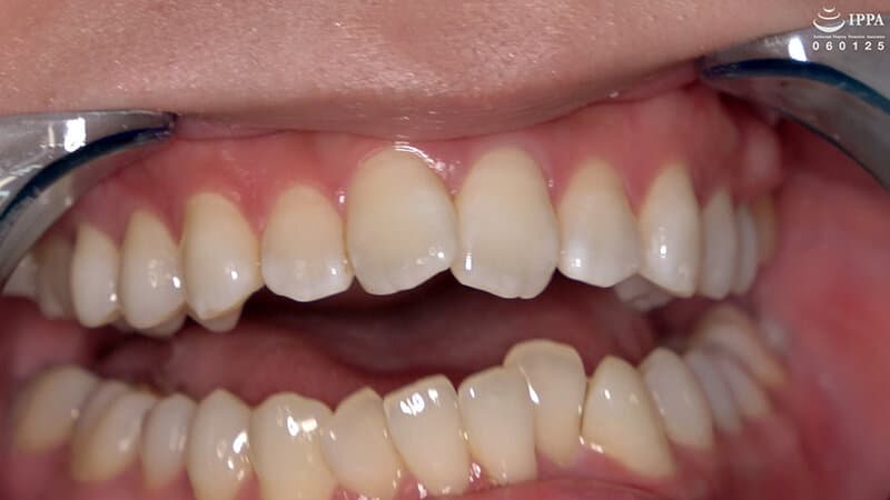Sample 4