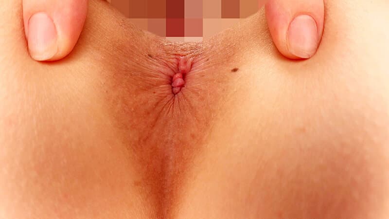 Sample 4