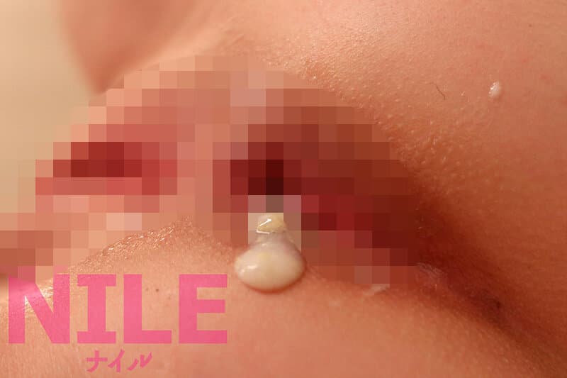 Sample 12