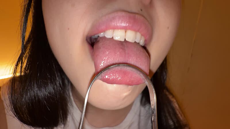 Sample 15
