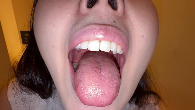 Sample 4