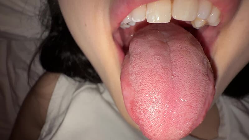 Sample 14