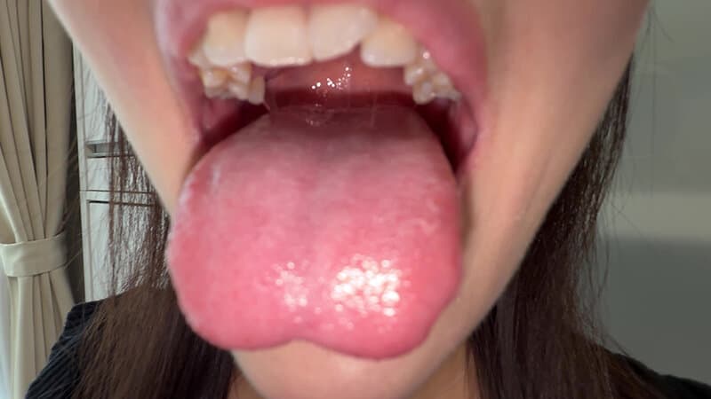 Sample 14