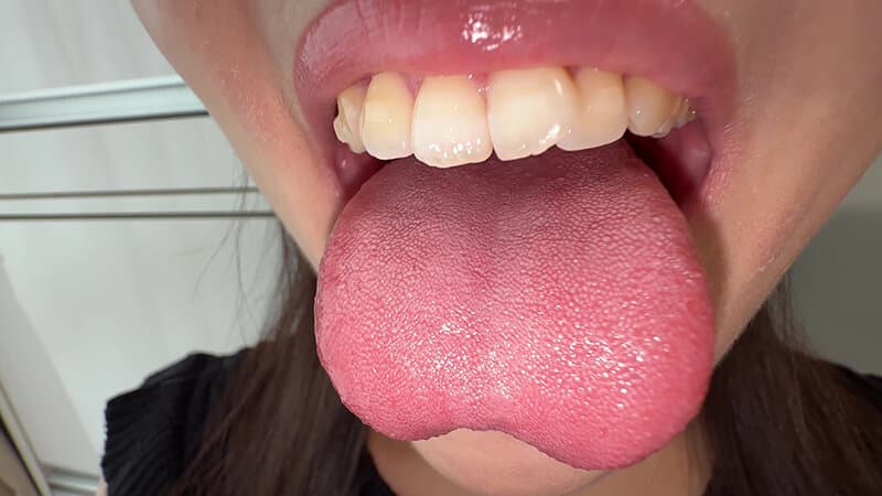 Sample 4