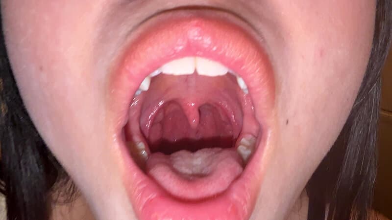 Sample 4