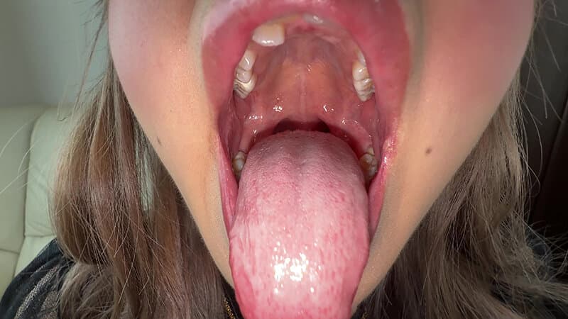 Sample 10