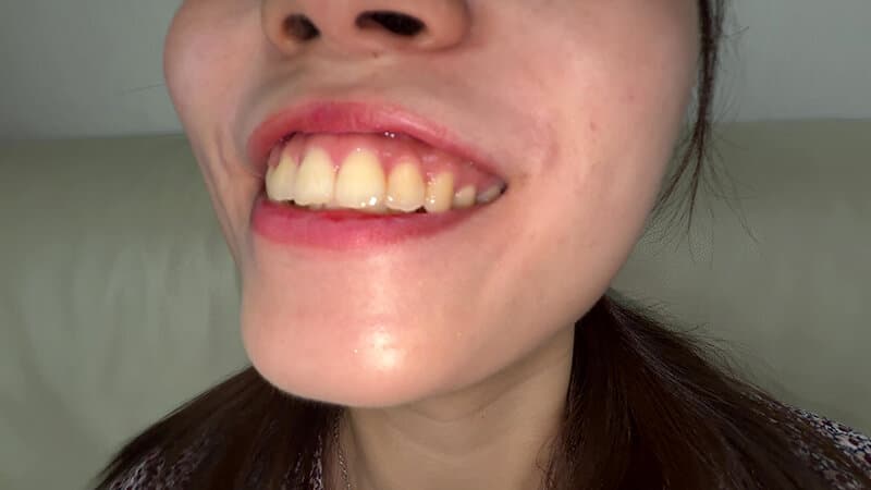 Sample 5