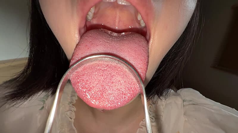 Sample 15