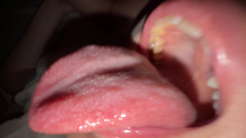 Sample 15