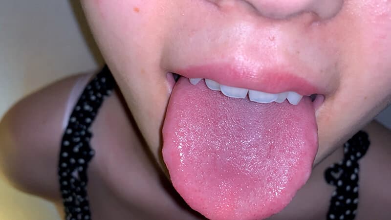 Sample 4