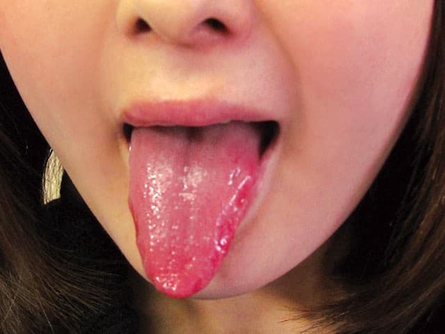 Sample 4