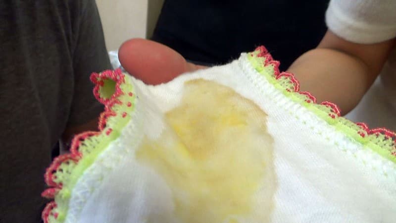 Sample 5