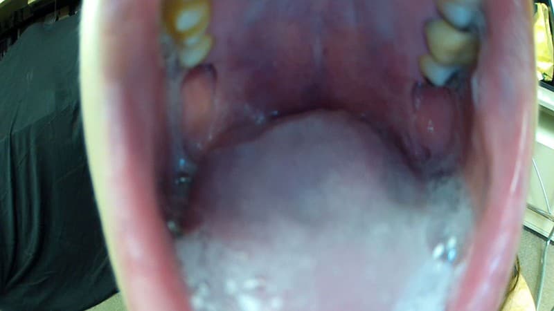 Sample 14