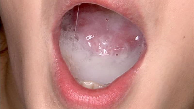 Sample 20